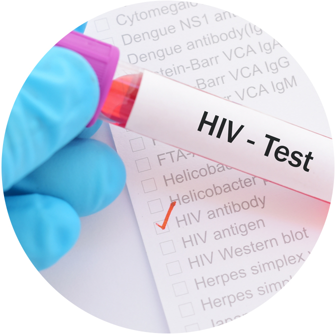 HIV test tube